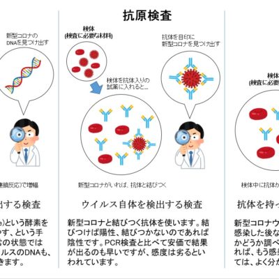 PCR検査・抗原検査・抗体検査の違いとは？