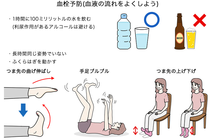 血栓予防(血液の流れをよくしよう)