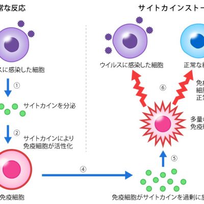 コロナ禍だからこそ治療しよう　④肥満