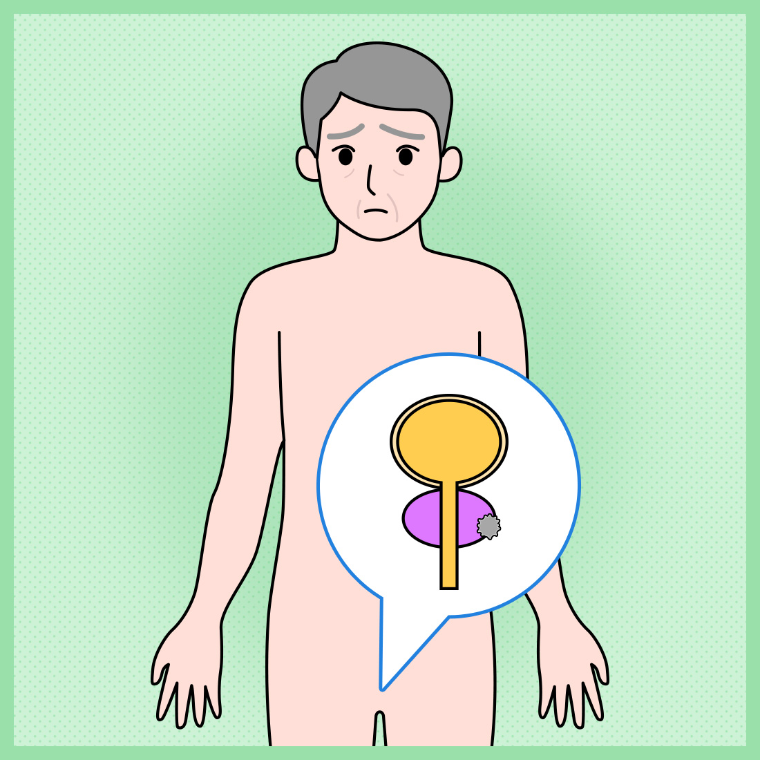 男性のがん罹患数1位の「前立腺がん」 　最新の診断方法で早期治療へ