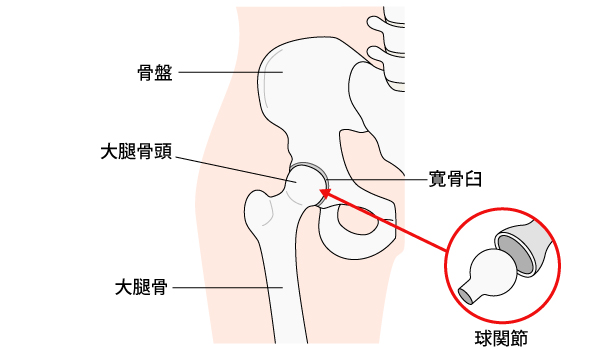 変形性股関節症 (へんけいせいこかんせつしょう)とは | 済生会