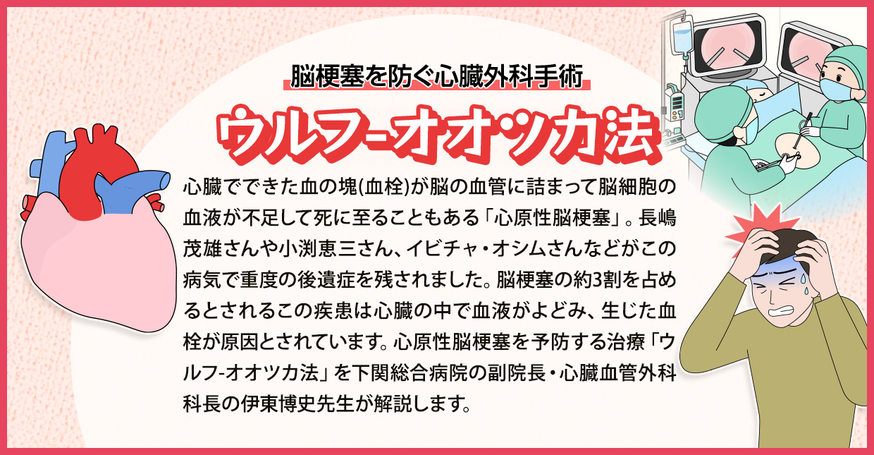 脳梗塞を心臓外科手術で予防する ウルフ-オオツカ法 | 済生会